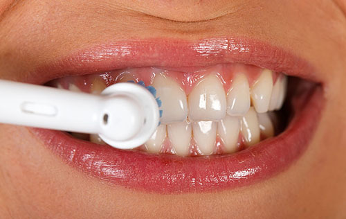 scale and polish home | Pestana Dental & Aesthetics