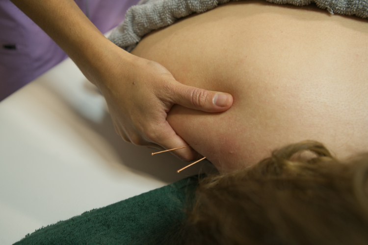 physio komal soni physiotherapy 3 | Pestana Dental & Aesthetics